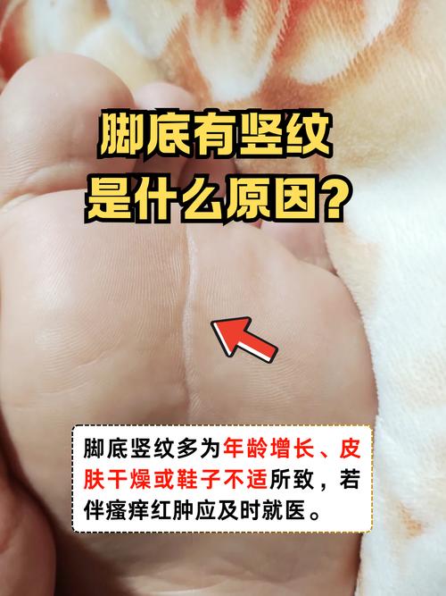 大富大贵脚底有竖纹