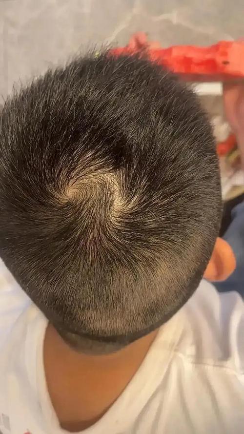 男人头顶双旋有什么说法？头顶双旋命运怎么样？