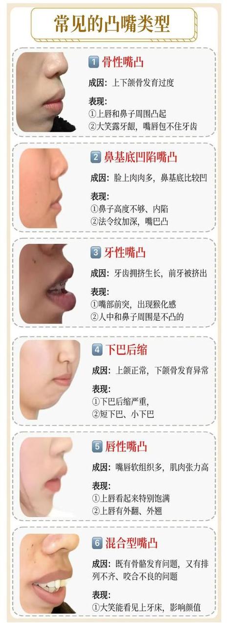 嘴歪面相