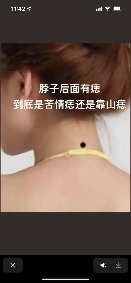 苦情痣点了之后运势会变差吗