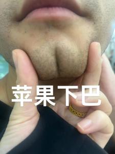 苹果下巴是什么 是富贵相吗