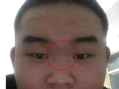 山根断财运好吗