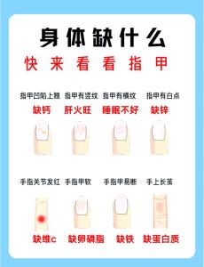 看指甲透露你的运势