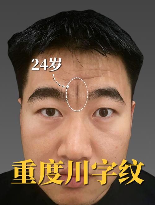 男人有川字纹运势怎么样