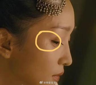 夫妻宫有疤的女人婚姻怎么样