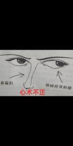 鼻梁歪斜的人面相分析
