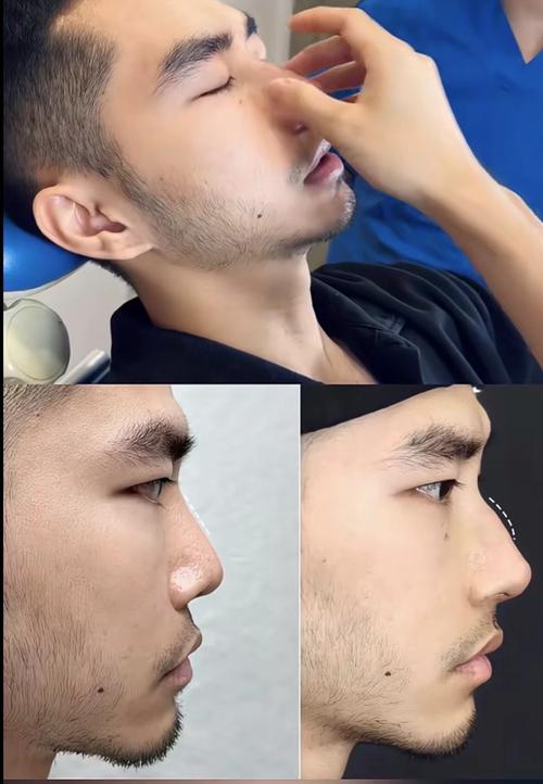 长了驼峰鼻的男人性格 拥有驼峰鼻的人性格固执