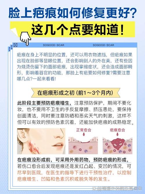 哪些面部疤痕影响运势