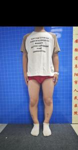 体相看富贵 罗圈腿的男人命运如何