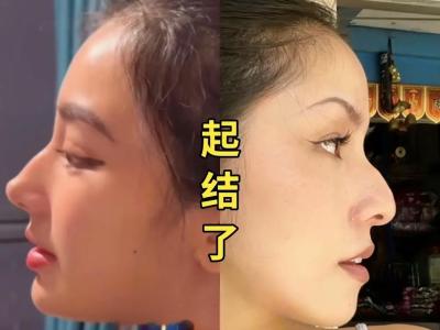 鼻梁起节的女人命运真的不好吗？