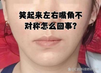 嘴唇左右不对称面相好不好