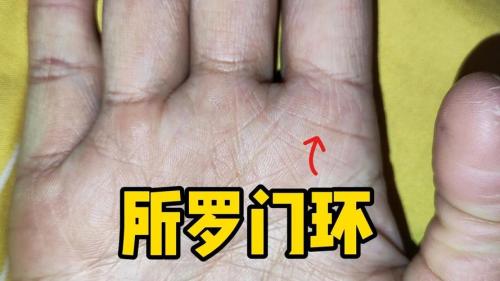 手掌中的辅助纹线——所罗门环