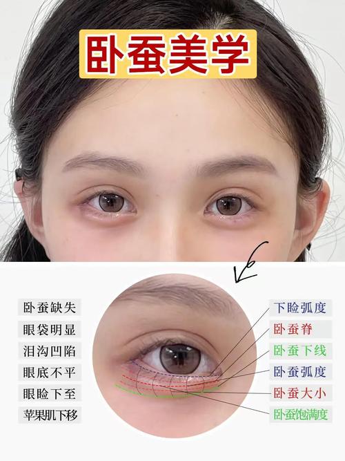 卧蚕眼面相到底好不好 有什么说法