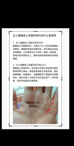 妻妾纹对婚姻运势有何影响呢