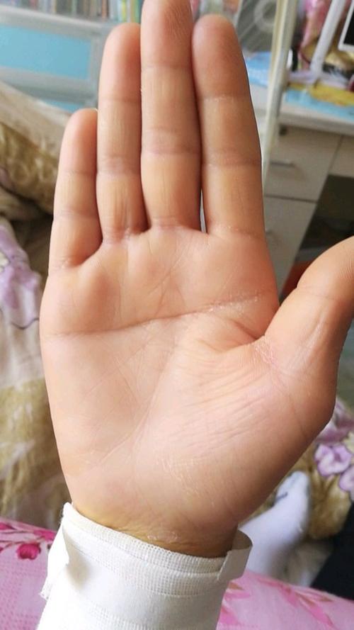 女孩右手断掌纹