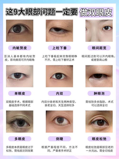 割双眼皮忌讳什么风水
