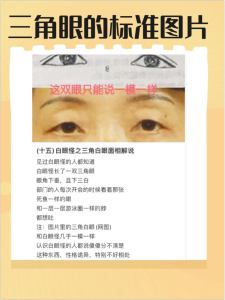 三角眼有几种，不同类型的三角眼图