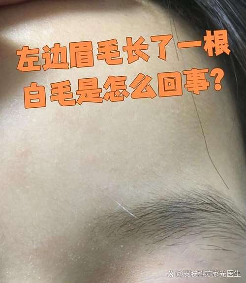 右边眉毛长白毛贵人