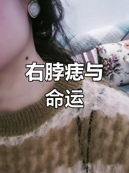 什么痣相的女人最受宠 脖子侧面有痣