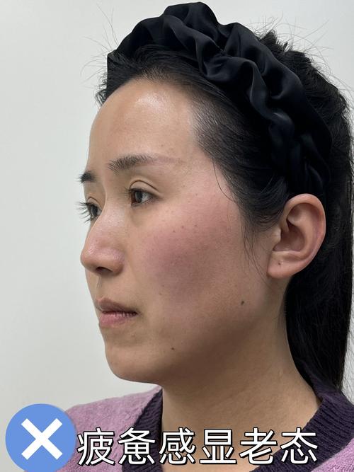 事业运很差的面部特征 无心定向