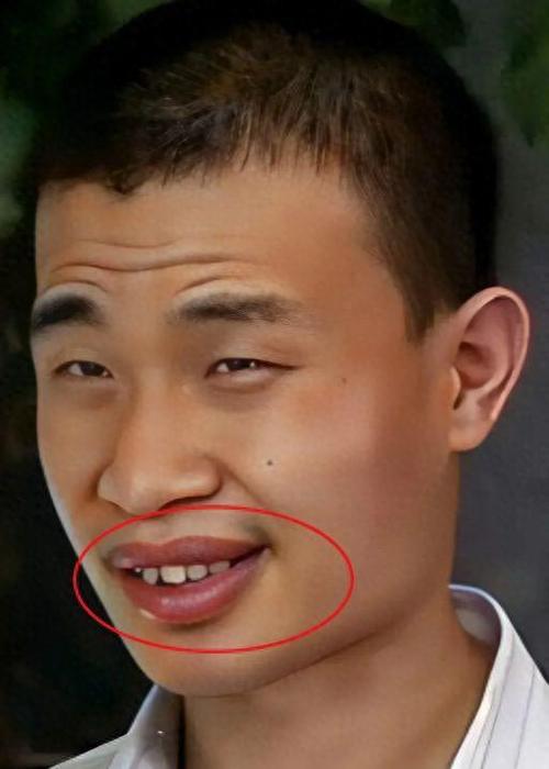 男人4种面相最苦命 牙齿很稀疏的男人命苦