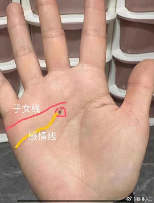 感情线上有痣是何影响