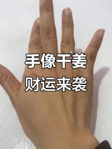 什么是干姜手的特征 预示着什么