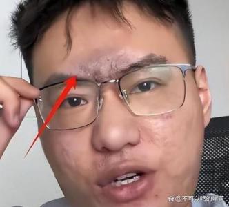 印堂发黑必有大凶之兆 说的是真的吗