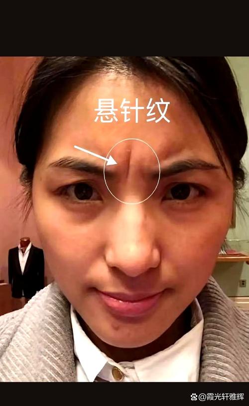 女人印堂有悬针纹好不好?