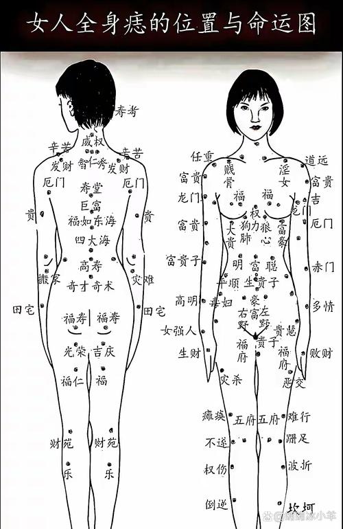 详解：屁股上有痣代表什么？