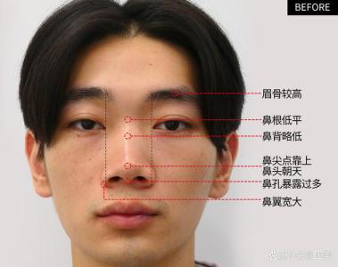 解析：鼻子小的男人面相
