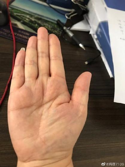 男生右手生命线短，身体抵抗力比较弱？