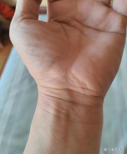 手腕竖纹多的人桃花运很旺吗