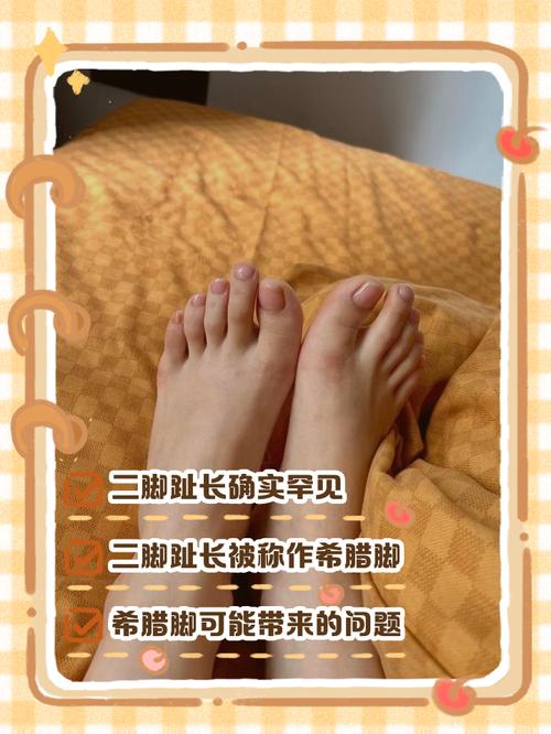 二脚趾比大脚趾长代表什么