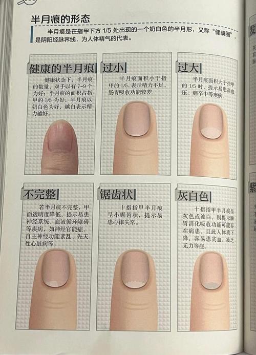 详解：唯独大拇指有半月痕好吗？