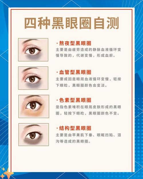 黑眼圈面相代表什么？