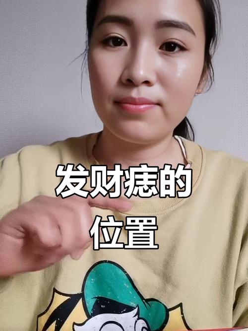 爆发横财痣长在什么地方