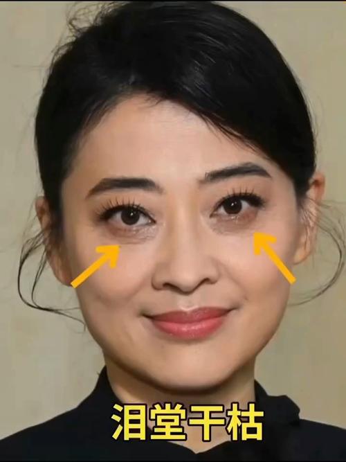 泪窝面相 有泪窝的人运势好不好