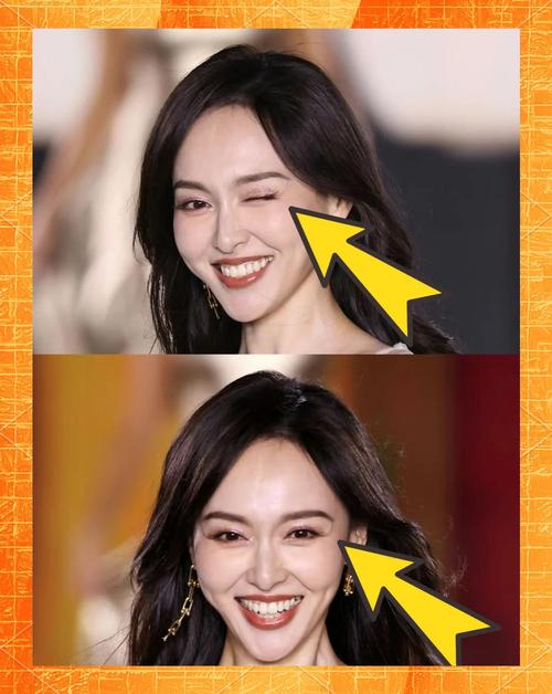 鱼尾纹面相：什么是鱼尾纹