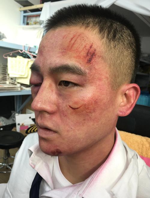 男人的硬伤 最难成大器的男人面相