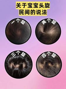 头上有三个旋在面相学上代表什么