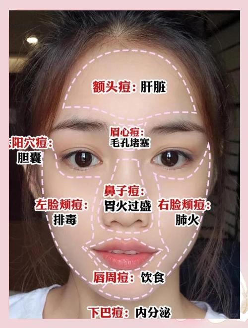 眉毛上长痘痘是什么原因？看健康
