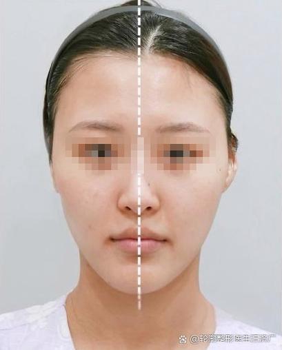 锥子脸面相不可交往