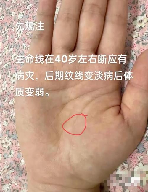 生命线尾端出现鱼纹