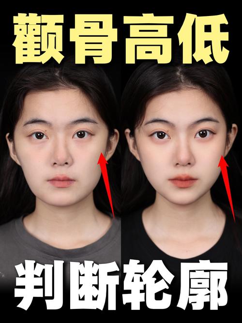 高颧骨是什么样子
