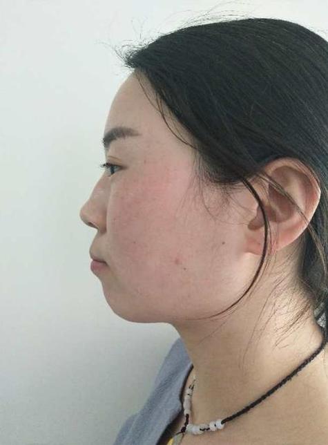 下巴短的女人有福气  孝顺父母多有福气