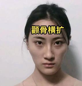 颧骨外扩横张女人面相