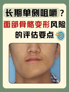 下巴突又弯会有怎样的影响呢