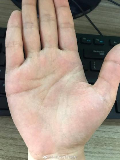 感情线断裂的手相意味着情感破裂吗？