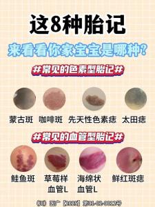 身上哪些胎记会犯桃花
